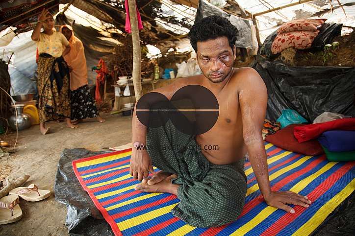 Rohingya Refugee at Tambru No-man's land in Bangladesh-Myanmar border at Tambru, Naikhyangchori, Banderban, Bangladesh