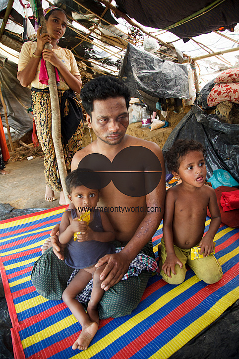 Rohingya Refugee at Tambru No-man's land in Bangladesh-Myanmar border at Tambru, Naikhyangchori, Banderban, Bangladesh