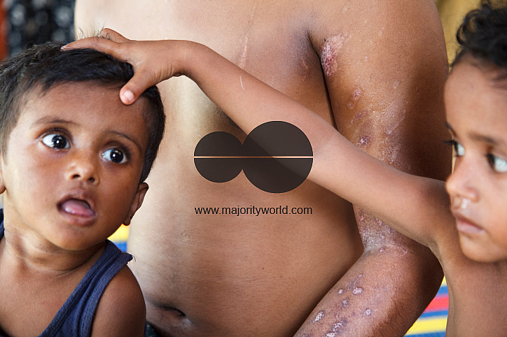 Rohingya Refugee at Tambru No-man's land in Bangladesh-Myanmar border at Tambru, Naikhyangchori, Banderban, Bangladesh