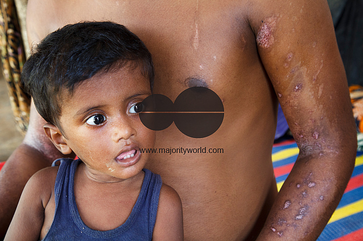 Rohingya Refugee at Tambru No-man's land in Bangladesh-Myanmar border at Tambru, Naikhyangchori, Banderban, Bangladesh
