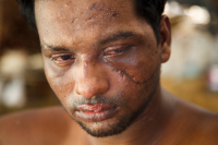 Rohingya Refugee at Tambru No-man's land in Bangladesh-Myanmar border at Tambru, Naikhyangchori, Banderban, Bangladesh