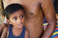 Rohingya Refugee at Tambru No-man's land in Bangladesh-Myanmar border at Tambru, Naikhyangchori, Banderban, Bangladesh